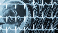 Disparities in MI Outcomes Persist Across Healthcare Systems