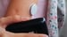 Type 1 Diabetes Management Improves as Technology Advances
