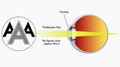 'Tunable' Lenses Offer New Way to Correct Presbyopia