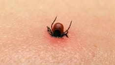 Vaccines, Better Tests Are Coming for Lyme Disease