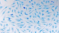 Cervical Cancer Screenings Double With Mailed DIY Kits