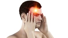 Migraine Headache Workup: Approach Considerations, Indications for ...