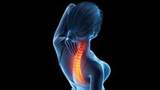 Fast Five Quiz: Nonradiographic Axial Spondyloarthritis Management