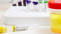 New Guidelines on Diabetes-Related Laboratory Testing