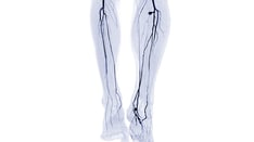 PAD Procedure Overuse: A Field in Peril or 'A Few Bad Apples'?