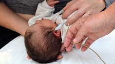 5 Things About Timely Hearing Screening, Diagnosis, and Intervention in Infants