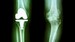 Does Continuity of Care Affect Outcomes After Arthroplasty?