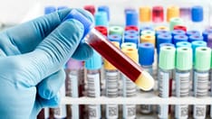 A Blood Test to Diagnose Bipolar Disorder?