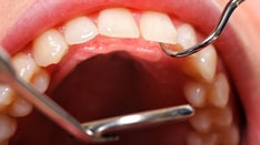 Not Enough Evidence for Primary Care to Routinely Conduct Dental Screenings