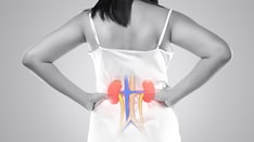 Risk Calculator for Early-Stage CKD May Soon Enter US Market