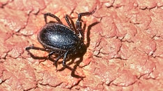 Fast Five Quiz: Tick-Borne Illnesses