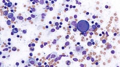 Rapid Review Quiz: Is It Human Parvovirus B19 Infection or Something Different?