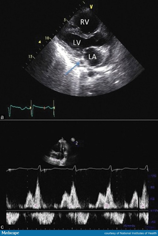 More Diagnostic Errors in Patients With Pulmonary Symptoms