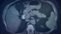 Rubinstein-Taybi syndrome, medical and dental care for special needs  patients: Clinical case report