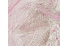 Gout for the Holidays