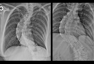 Growth Disorders: 7 Cases
