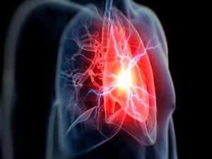 Dapagliflozin's HFpEF Benefit Recasts HF Treatment: DELIVER