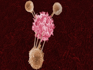 Made-to-Order TILs Effective Against Metastatic Melanoma