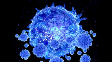 rheumatoid arthritis medscape duzzadt ujjízület gyulladás