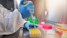 Alzheimer's Disease: What's in the Research Pipeline?