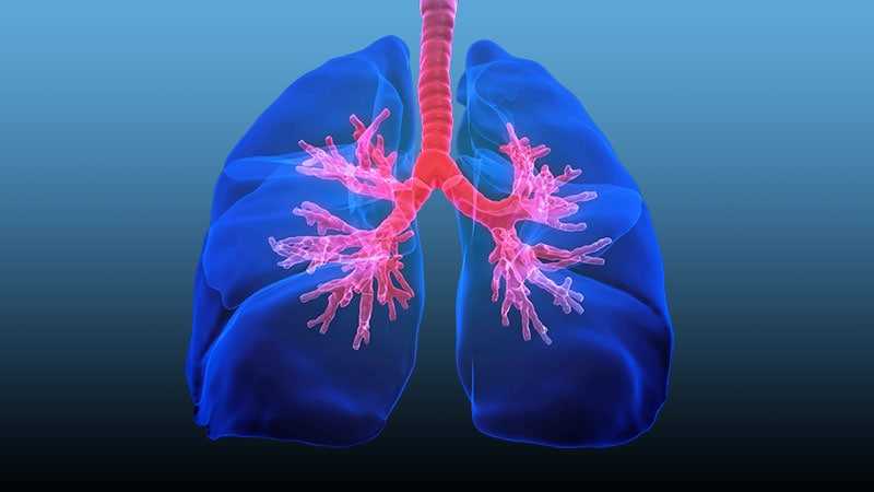 Lung Cancer | Medscape