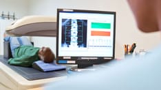 Hormone Agonist Therapy Disrupts Bone Density in Transgender Youth