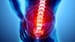 Retraining the Brain May Eliminate Chronic Back Pain