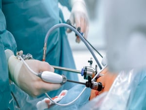 Bariatric Surgery an Epilepsy Risk Factor?