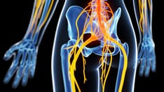 Placebo Response in Neuropathic Pain Trials