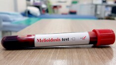 What Caused a Series of Cases of Melioidosis?
