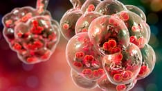 Acute Otitis Media Pneumococcal Disease Burden in Children Due to Serotypes Not Included in Vaccines