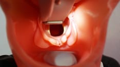 Gender-Affirming Laryngoplasty: Complications Relatively Common