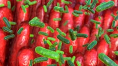 Long-Term Type 1 Diabetes Complications Tied to Gut Microbiome Changes