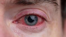 Trifluridine ophthalmic dosing, indications, interactions, adverse ...