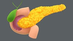 Pancreatic Cancer Screening Appears Safe, Effective for High-Risk Patients