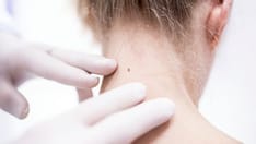 Head-to-Toe Skin Cancer Exam in Primary Care Does More Harm Than Good