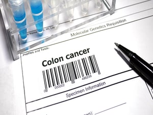 Two Multitarget Stool Tests Show Promise for CRC Screening