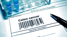 Are You Employing Genetic Testing Correctly for Colorectal Cancer?
