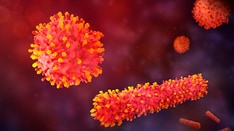 Q&A: Respiratory Syncytial Virus