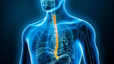How to Manage Esophageal Conditions: Expert Pearls
