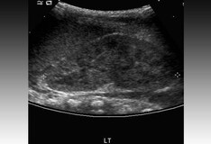 chlamydia ultrasound genitourinary chlamydial infections workup renal medscape bladder
