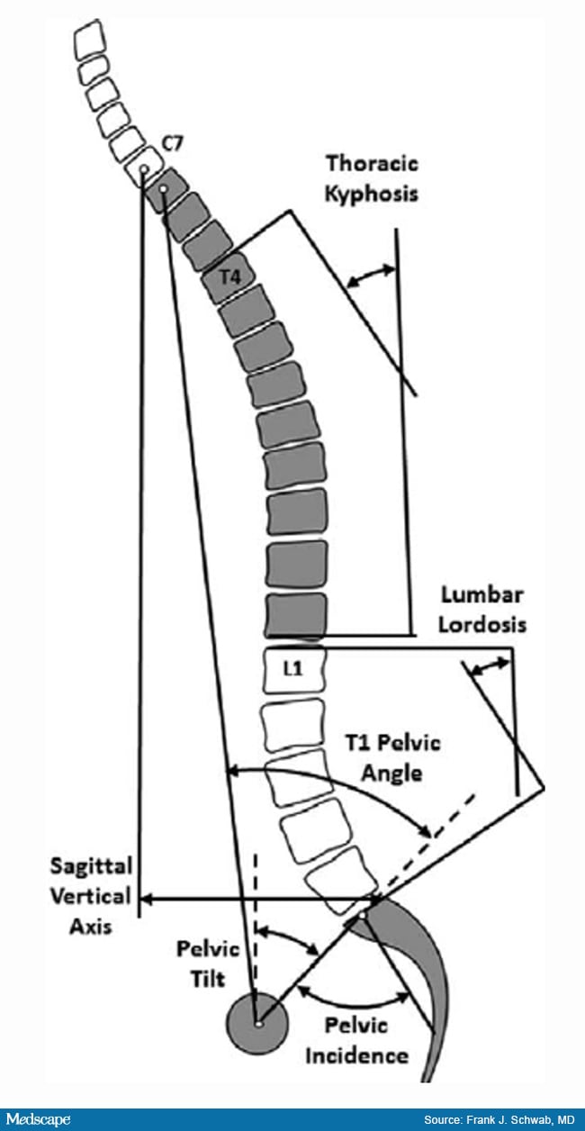 Valuable Tools for Spinal Surgery Planning