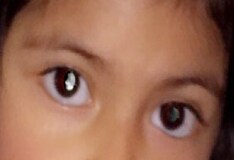 contact lenses the risks