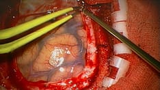 7 Potentially Devastating Traumatic Brain Injuries