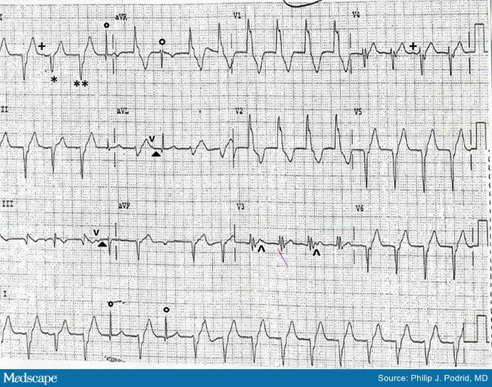 ECG Challenge: 'I'm Having Trouble Breathing' - Page 2