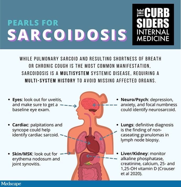 Suspect Sarcoidosis? Here's What to Assess