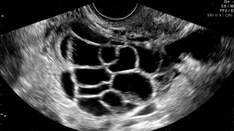 28-Year-Old Writer With Bilious Vomiting