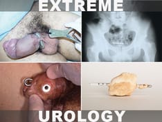 What the Urologist Saw