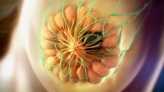 Internal Mammary Lymph Node Radiation Safe Over the Long Term