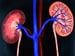 FDA: Metformin Safe for Some Patients With Renal Problems